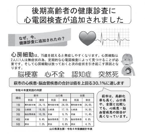 なぜ心電図検査が追加されたの？